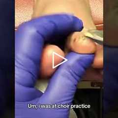 Nail care and vertigo? Here's the connection #feet #health #shorts