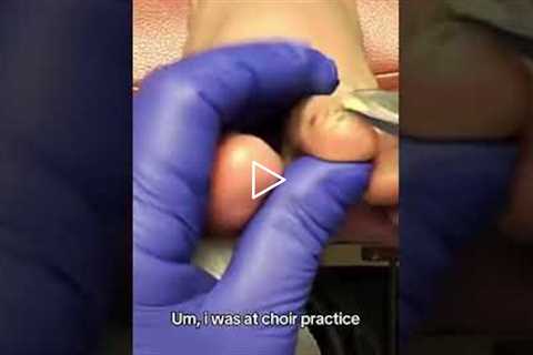 Nail care and vertigo? Here's the connection #feet #health #shorts